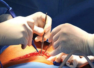 general-surgery-and-surgical-gastroenterology