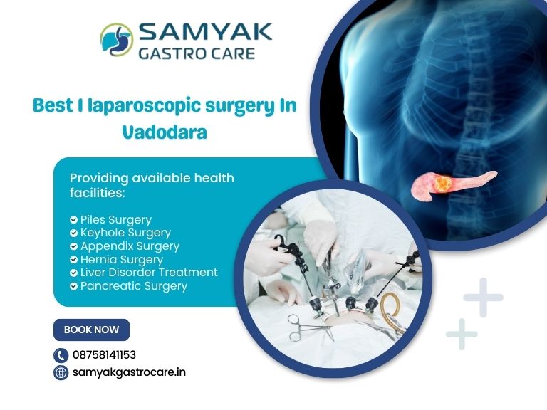 Best 1 laparoscopic surgery In Vadodara