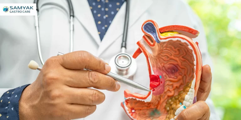 top gastroenterologist in vadodara for gastric problem